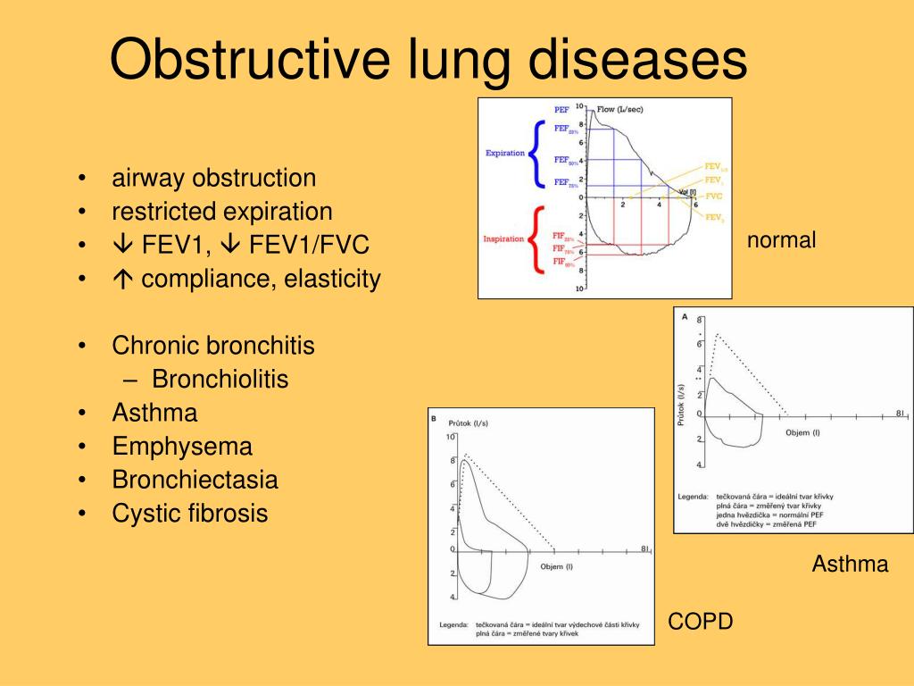 Causes Of Obstructive Lung Disease