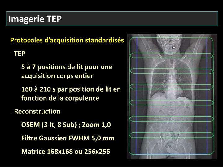 PPT - Techniques d’imagerie abdominale en médecine PPT - Techniques d’imagerie abdominale en médecine