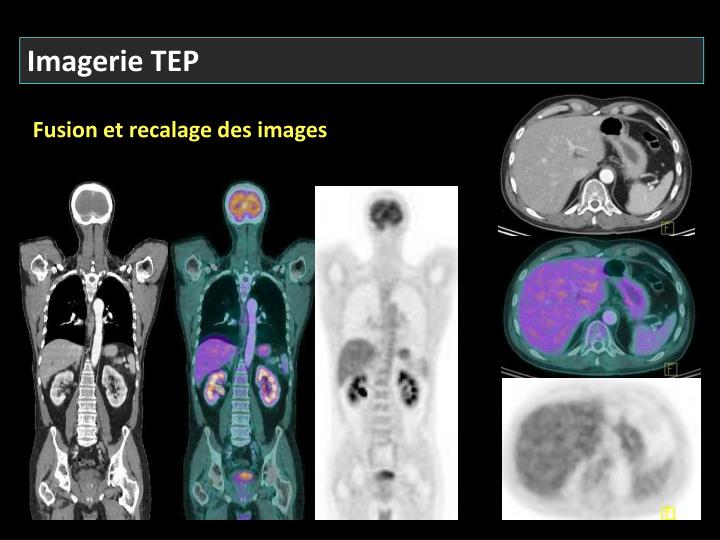 PPT - Techniques d’imagerie abdominale en médecine PPT - Techniques d’imagerie abdominale en médecine