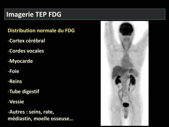 PPT - Techniques d’imagerie abdominale en médecine PPT - Techniques d’imagerie abdominale en médecine