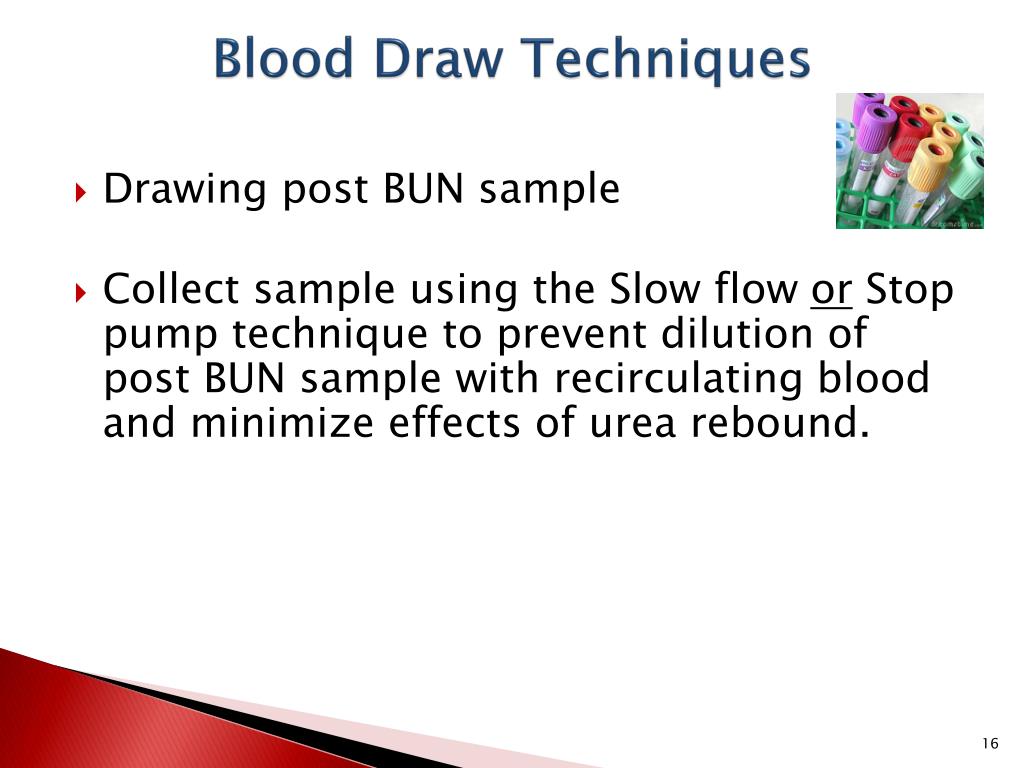 Scribble Drawing Technique : Ppt hemodialysis adequacy powerpoint presentation id