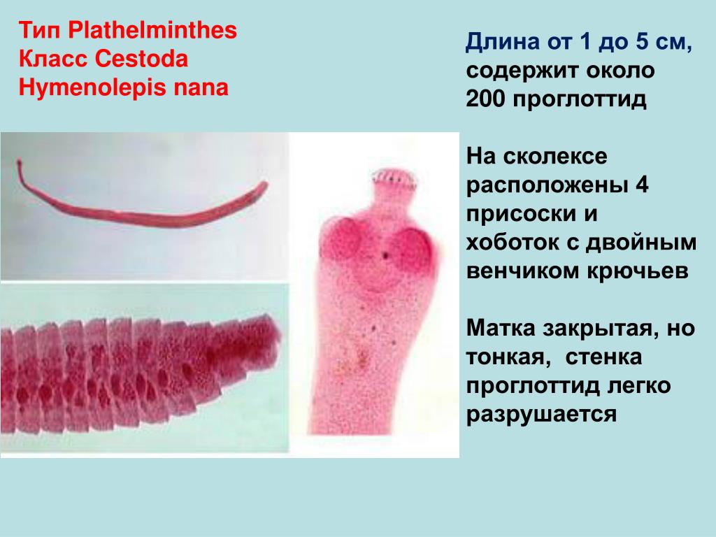 Членики ленточного червя. Карликовый цепень (Hymenolepis Nana). Карликовый цепень (Hymenolepis Nana) сколекс. Карликовые цепни (Hymenolepis папа).