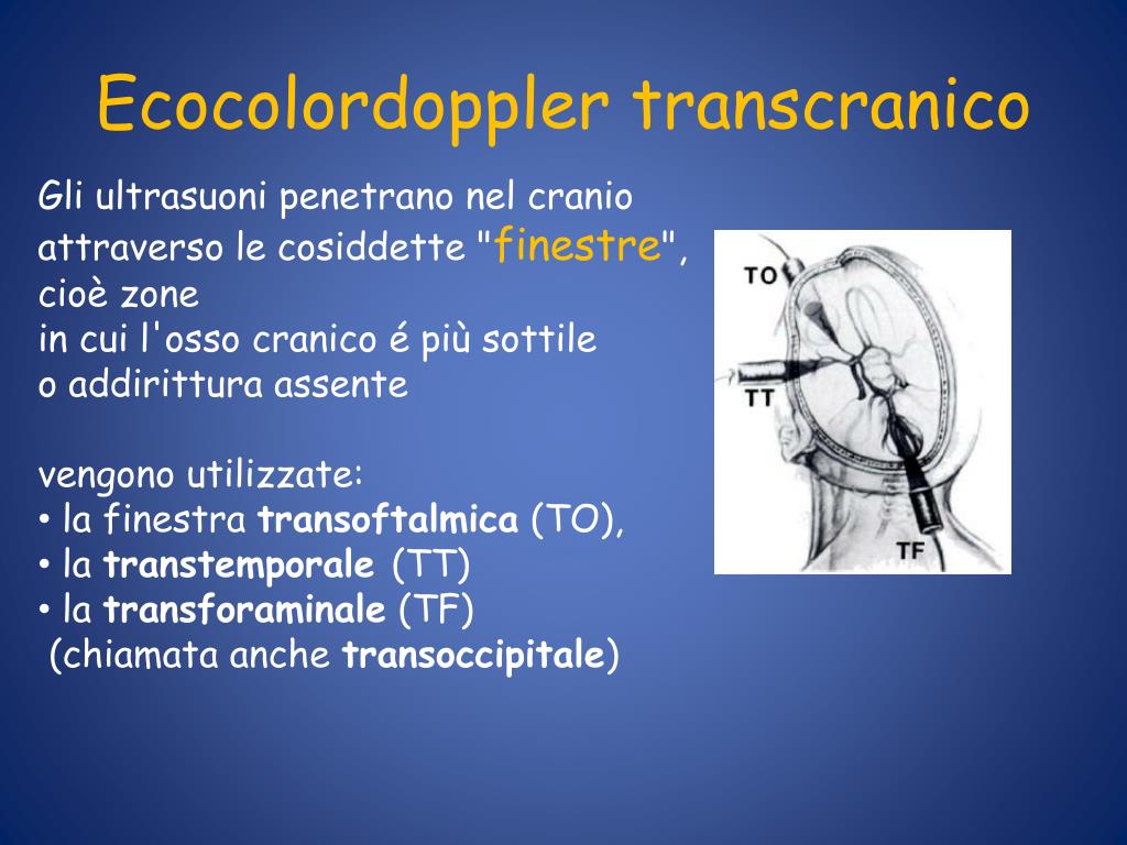 PPT - ECOCOLORDOPPLER TRANSCRANICO CON MEZZO di CONTRASTO PowerPoint  Presentation - ID:589516