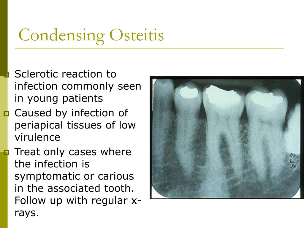 PPT Oral Path Review PowerPoint Presentation, free download ID589654