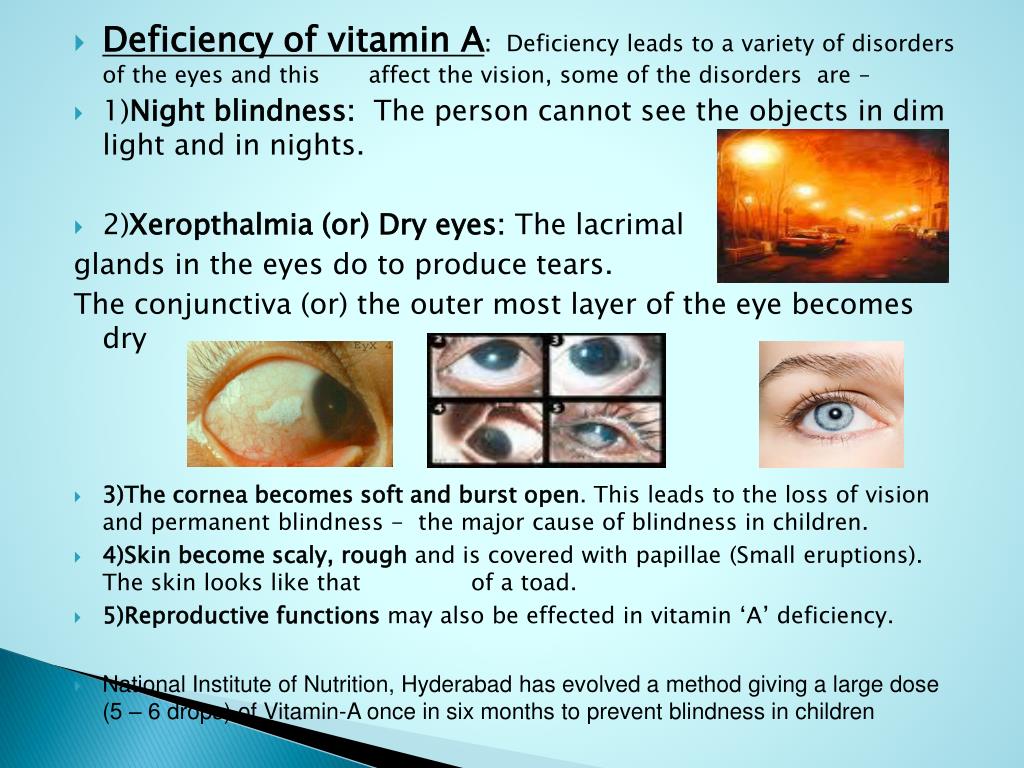 Vitamin deficiency