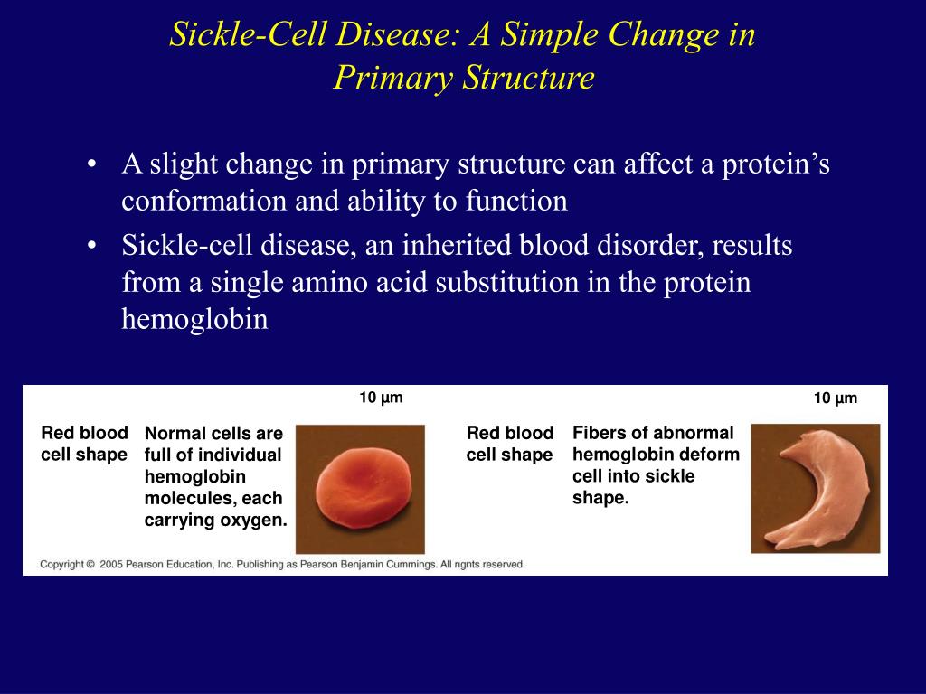 sickle cell disease international relations sickle cell disease international relations