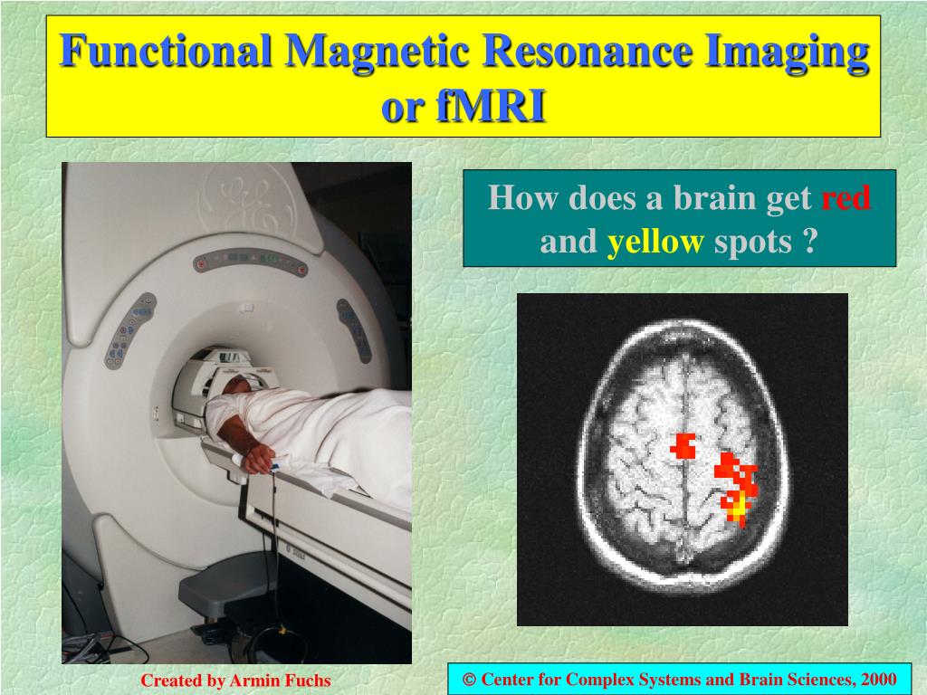 PPT - Functional Magnetic Resonance Imaging or fMRI PowerPoint Presentation  - ID:600056