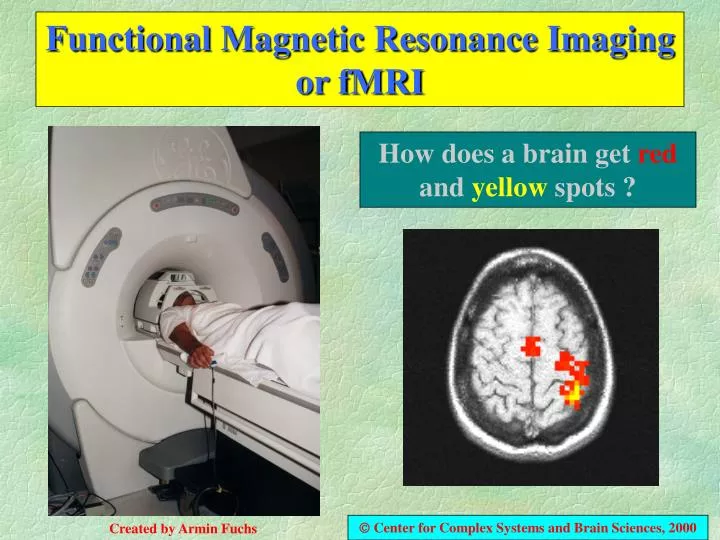 PPT - Functional Magnetic Resonance Imaging or fMRI PowerPoint Presentation  - ID:600056