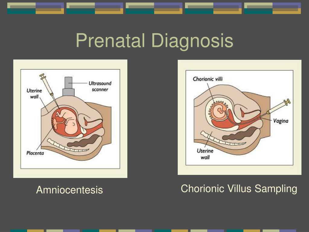 ppt-chapter-4-prenatal-development-and-birth-powerpoint-presentation