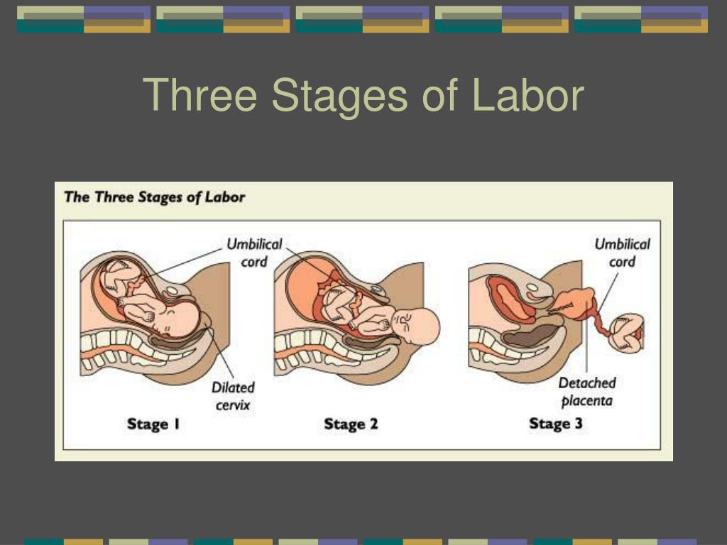 presentation in child birth