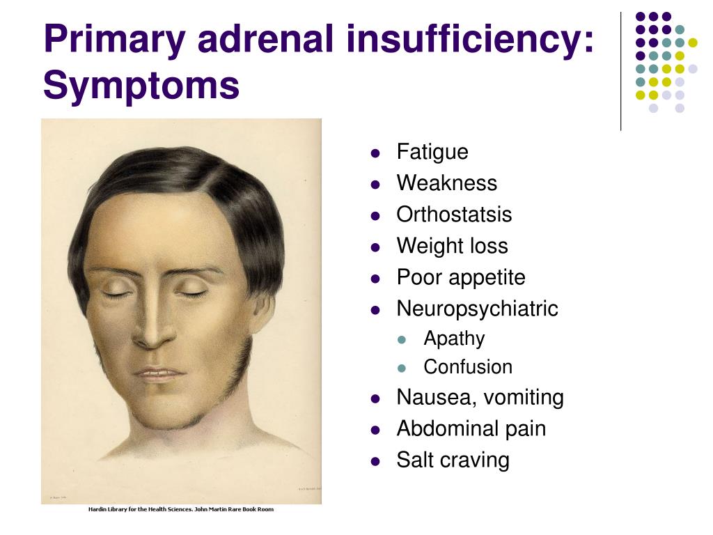 signs of adrenal problems signs of adrenal problems