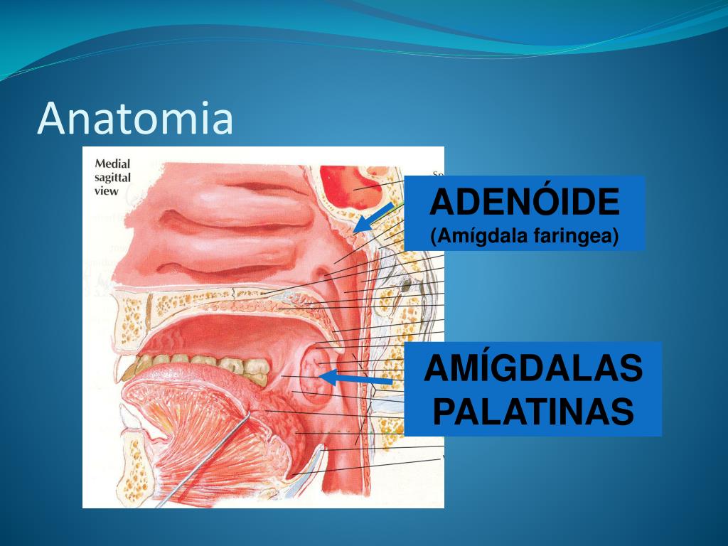 PPT - ENFERMIDADES DE AMÍGDALAS E ADENÓIDES PowerPoint Presentation, free  download - ID:617717, image size:1024x768