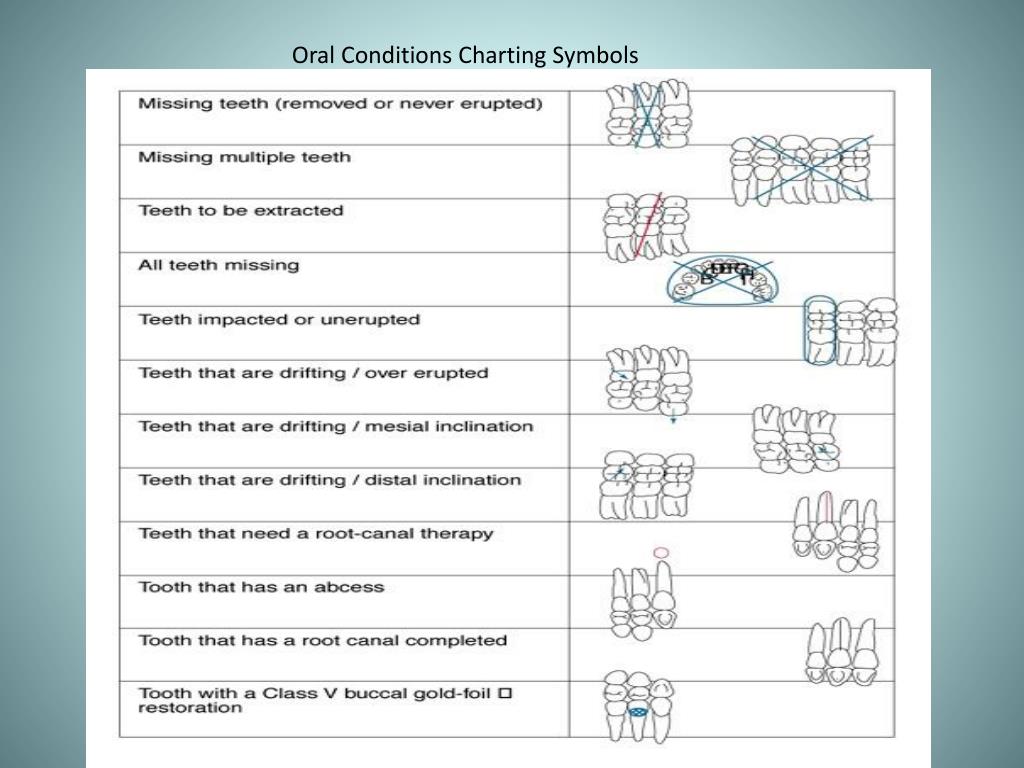PPT - DENTAL CHARTING PowerPoint Presentation, free download - ID:618992