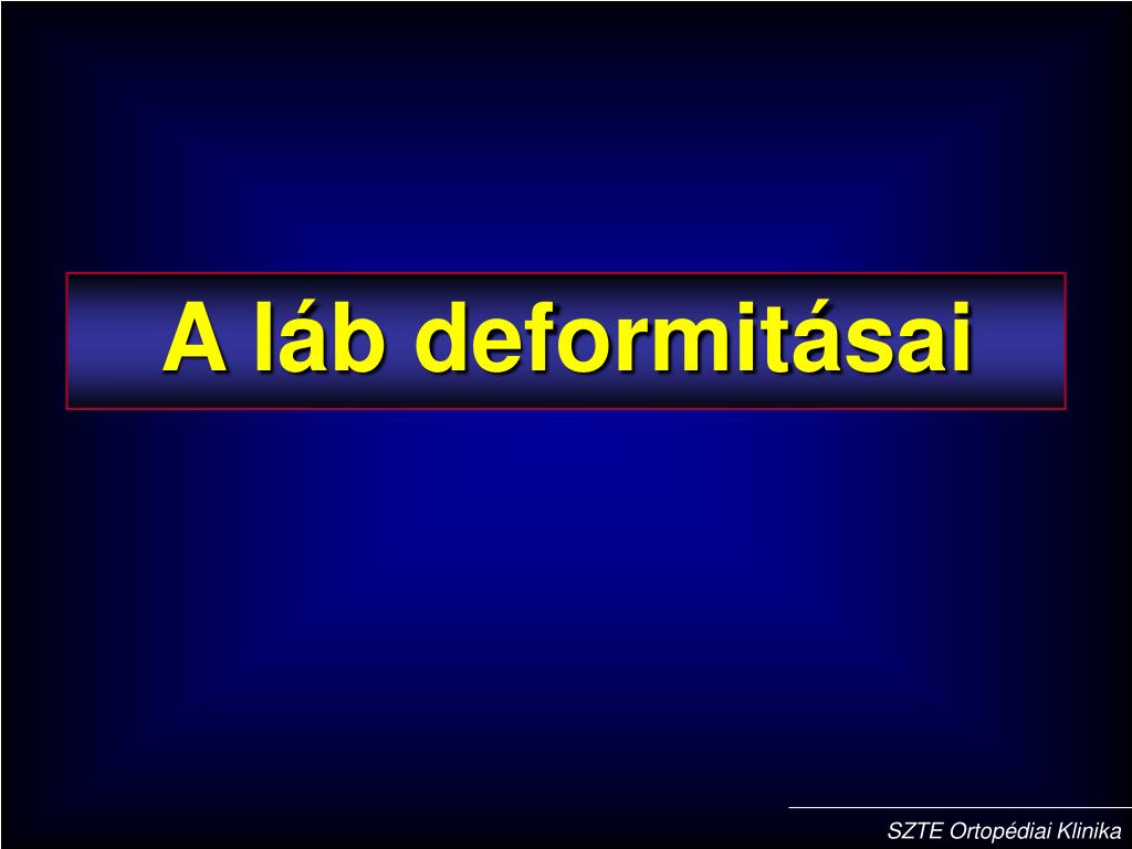PPT - A láb deformitásai PowerPoint Presentation, free download - ID:619434