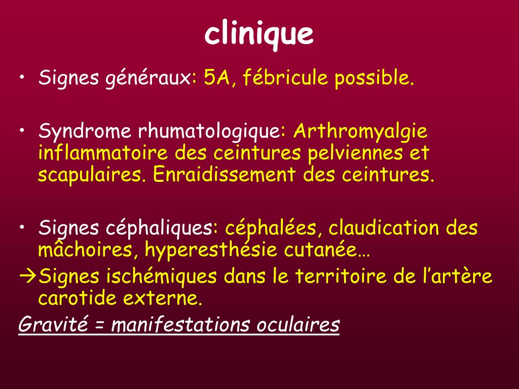PPT - Les vascularites PowerPoint Presentation, free download - ID:628310