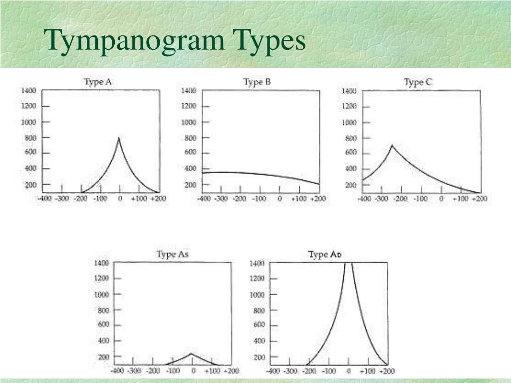 PPT Anatomy and Physiology of the Ear PowerPoint Presentation, free