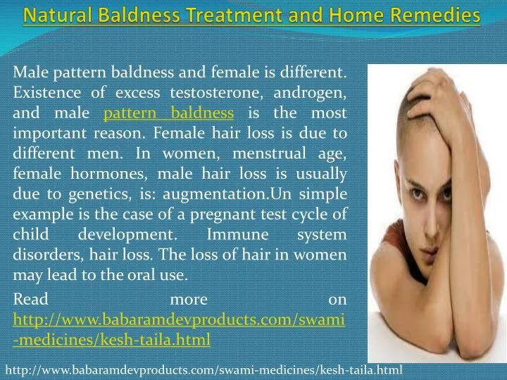 natural baldness treatment and home remedies n.