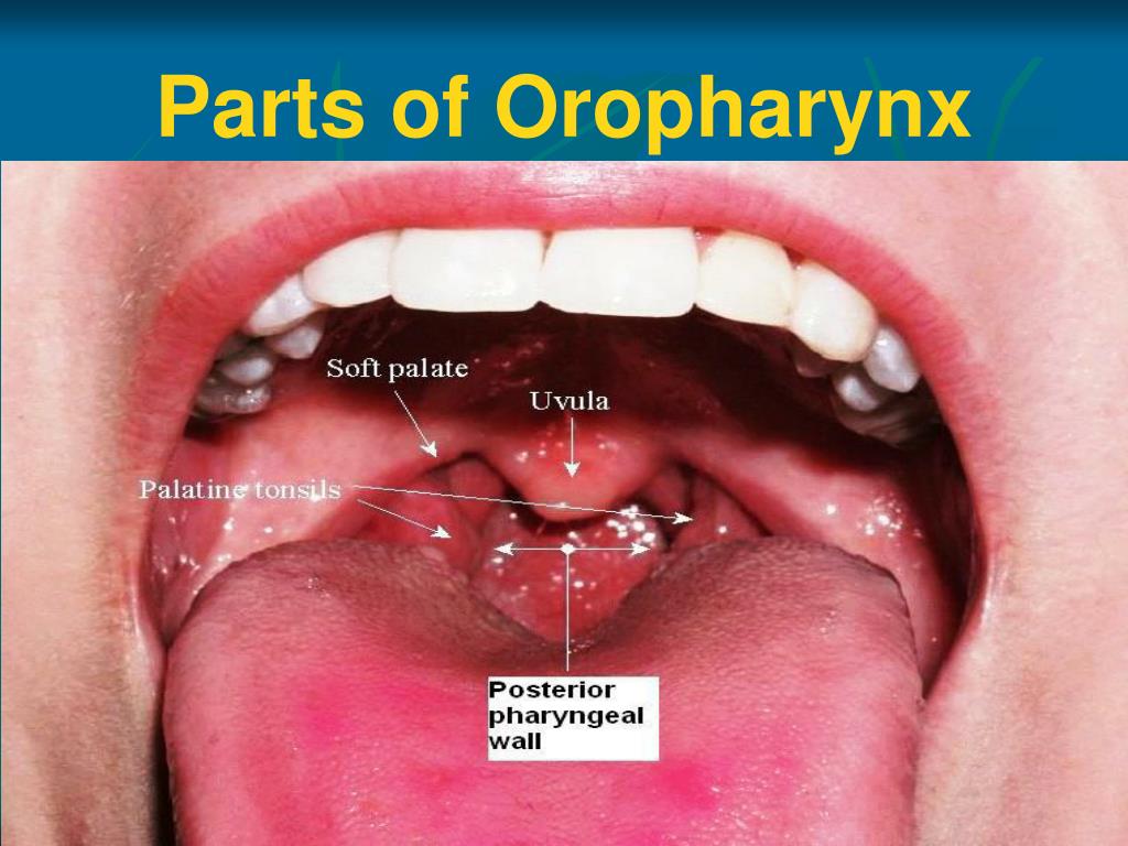 Posterior Wall Of Oropharynx