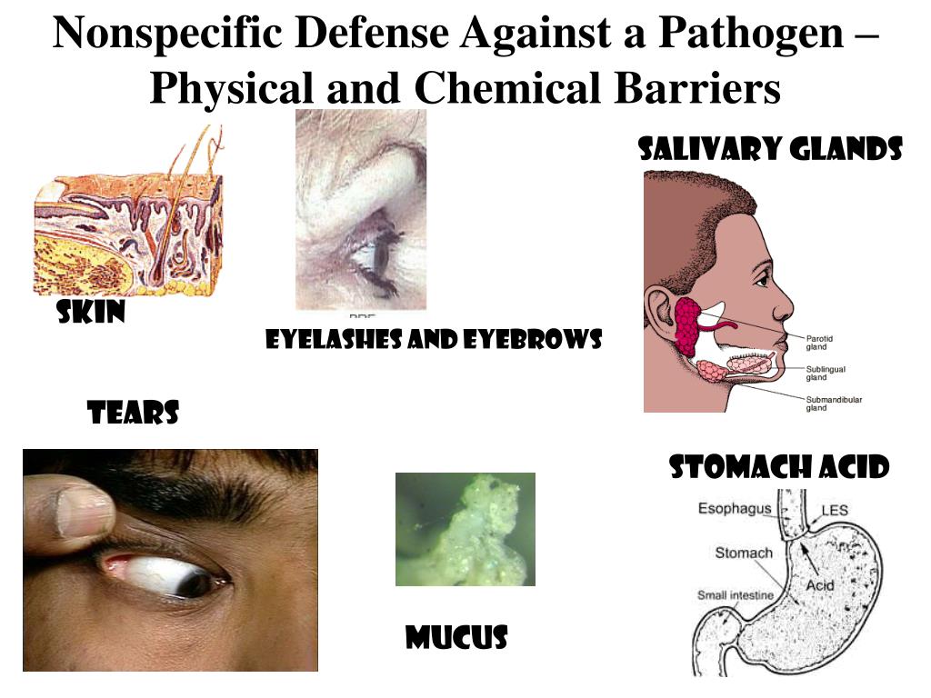 PPT - The body’s natural defense Against pathogenic organisms PowerPoint Presentation - ID:635359
