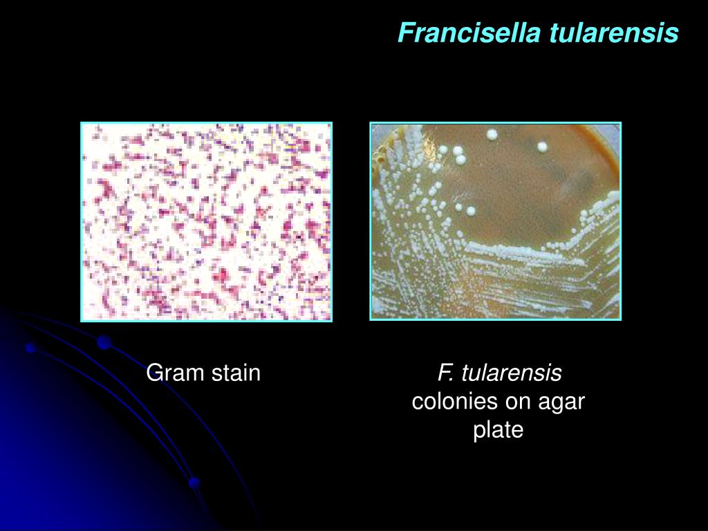 PPT Fe A Bartolome MD DPASMAP Department Of Microbiology PPT Fe A Bartolome MD DPASMAP Department Of Microbiology