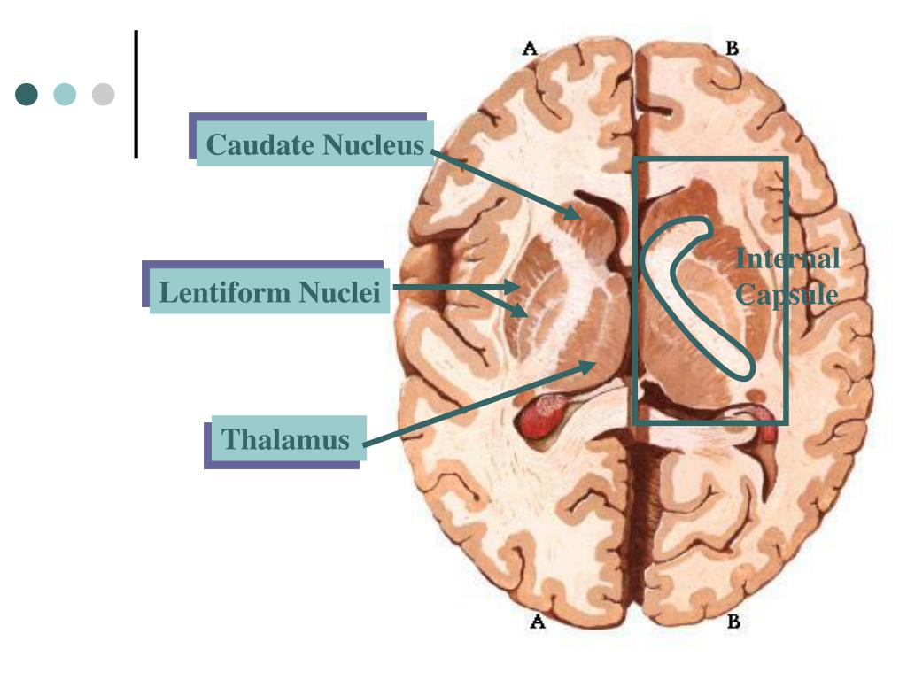 Хвостатое ядро мозга. Чечевицеобразное ядро, Nucleus lentiformis. Базальные ядра мозга строение. Базальные ядра Telencephalon. Скорлупа базальные ядра.