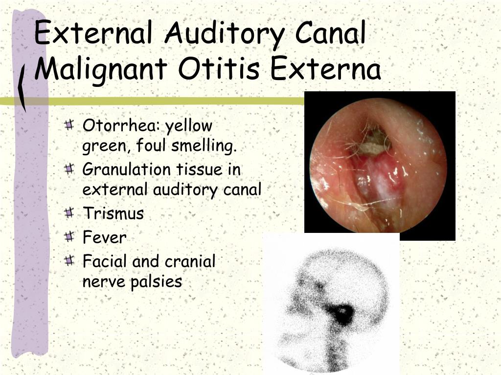 Ppt Approach To Ear Problems Powerpoint Presentation Free Download