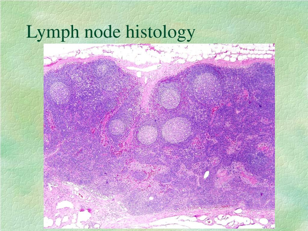 pathological lymph node