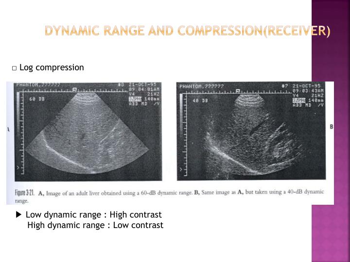PPT Chapter3 PulseEcho Ultrasound Instrumentation PowerPoint