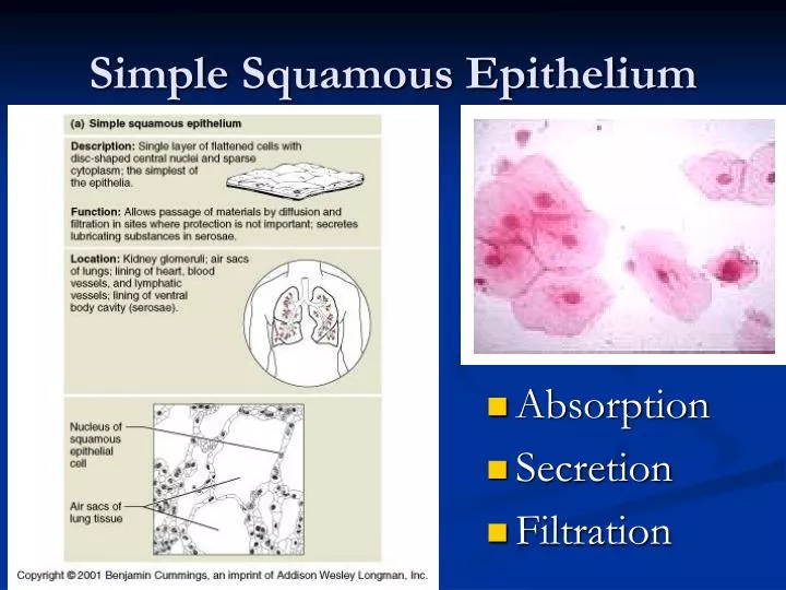 Simple Squamous Epithelium Function Location Structure