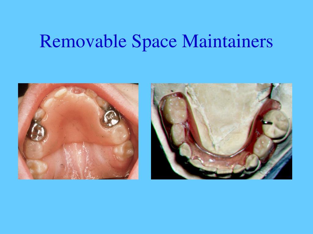 PPT Space Maintenance PowerPoint Presentation, free download ID653220