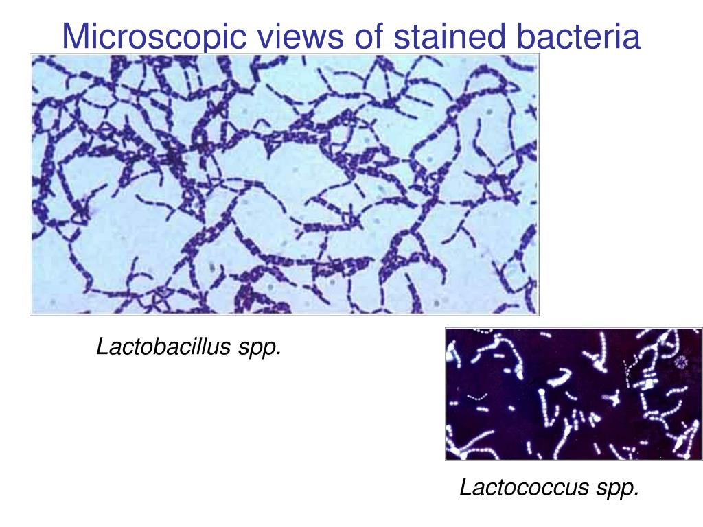 Бактерия spp. SPP бактерии. Лактобацилус SPP. Лактобациллы в мазке. Эндоспоры для Lactobacillus SPP.