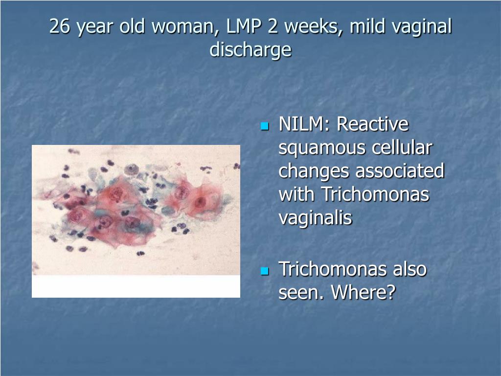 Vaginal odor