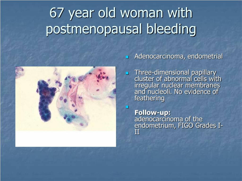 PPT - Cytology Training Program: Gyn Cytology Revision Exercise by