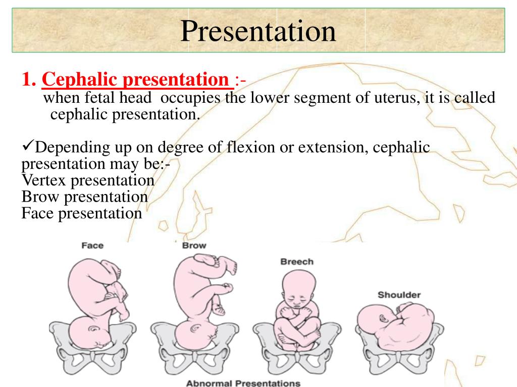 meaning of cephalic presentation and longitudinal lie