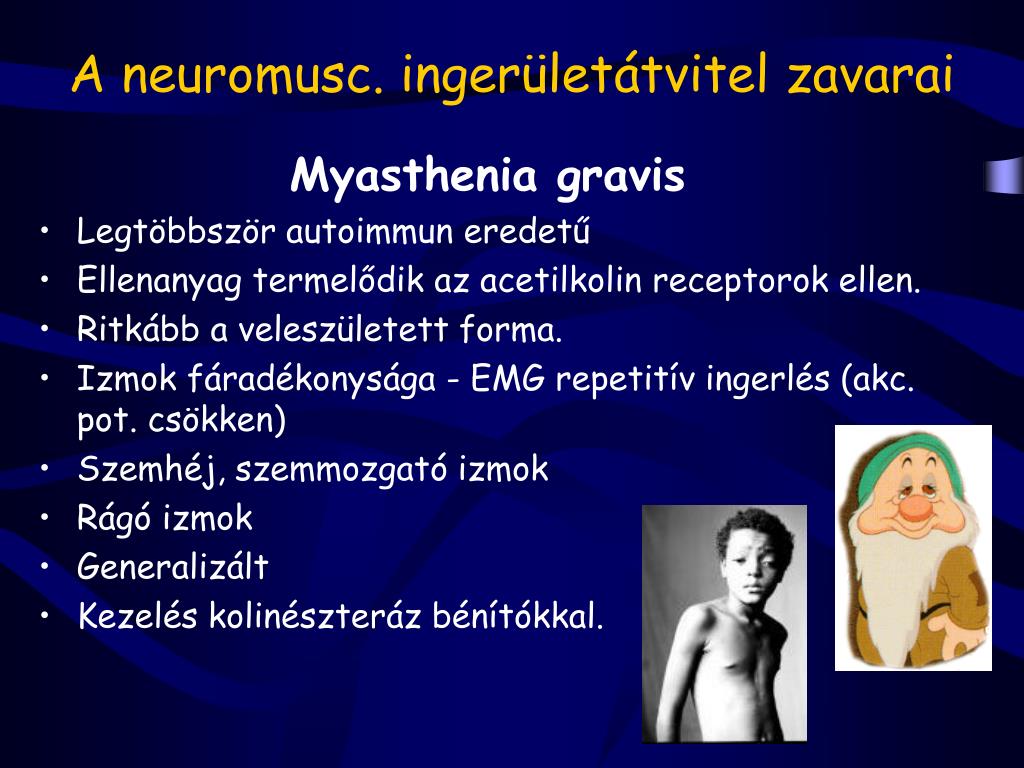 PPT - Neurológia 2. PowerPoint Presentation, free download..