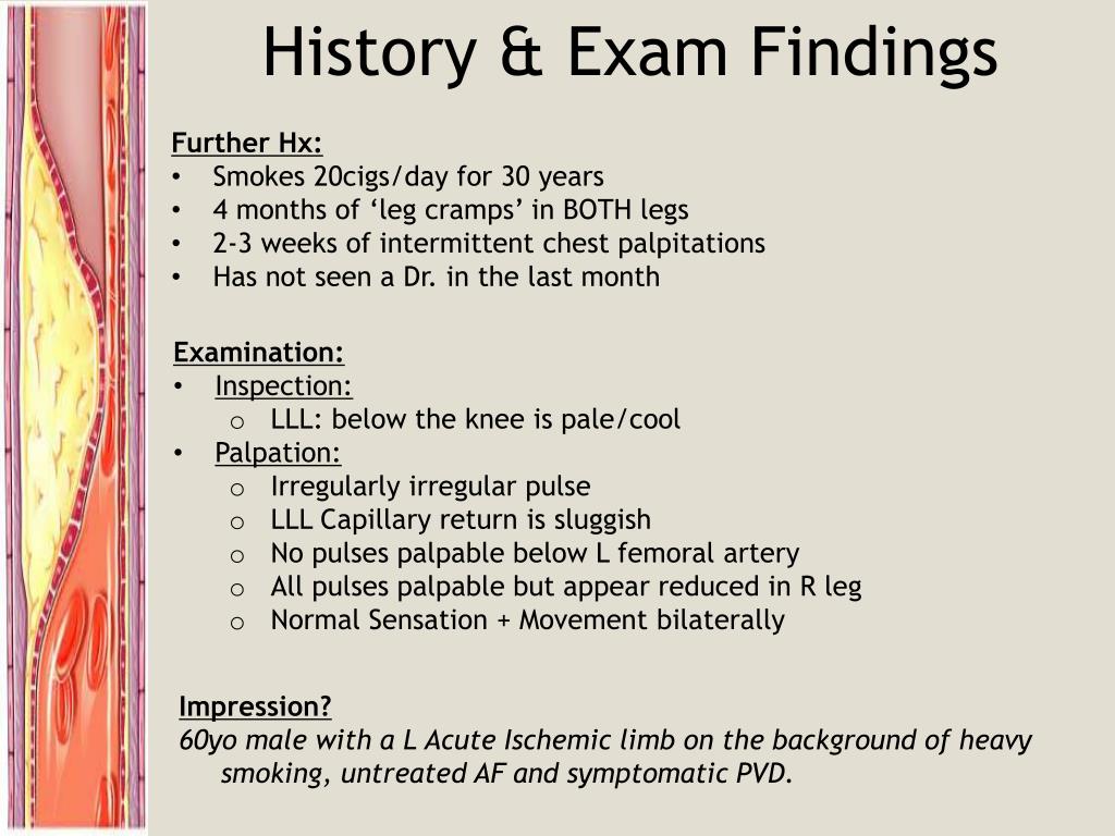 Acute Limb ischemia classification. Examination story. Plan of additional examination with ischemic Heart disease.