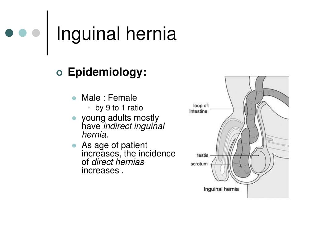Inguinal Hernia Surgical Anatomy