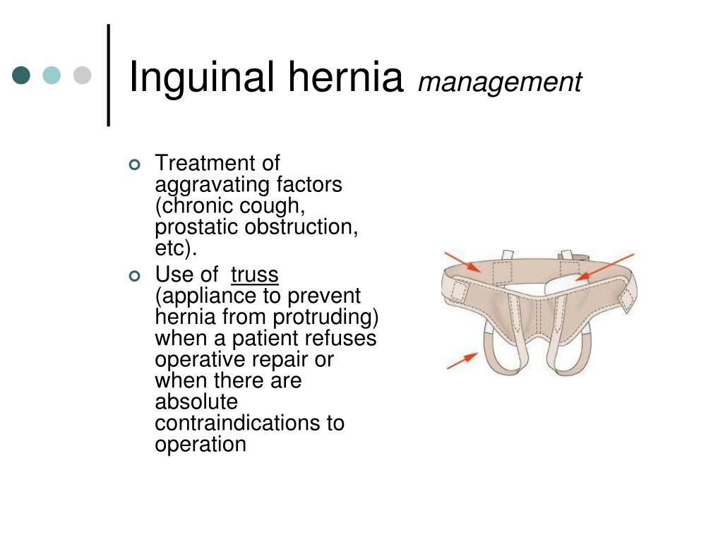 Ppt Hernias Powerpoint Presentation Free Download Id679255