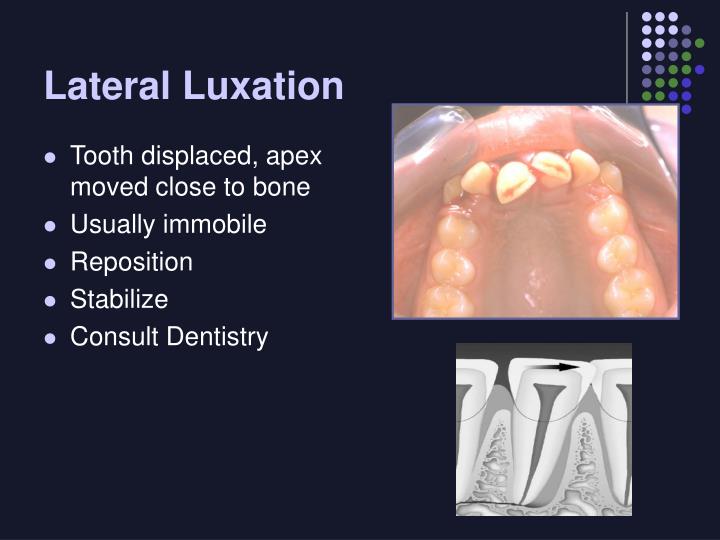 PPT Dental Trauma in the ED Fractures and Luxations PowerPoint
