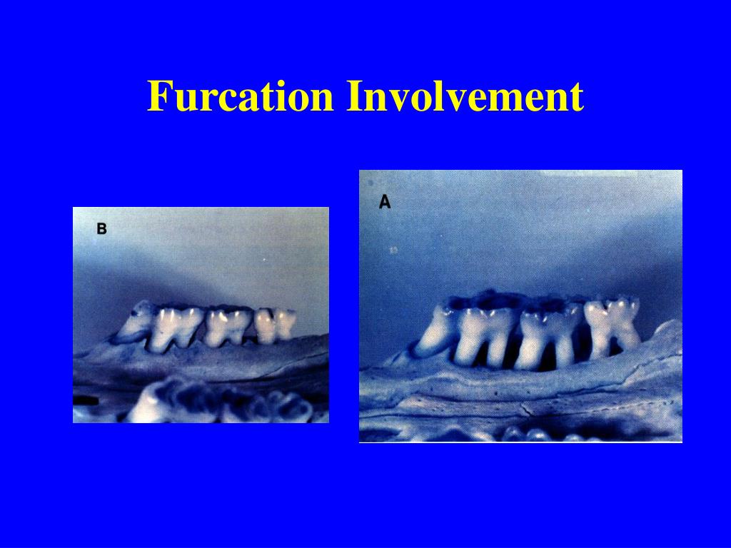 PPT - Dental Charting PowerPoint Presentation, free download - ID:686071
