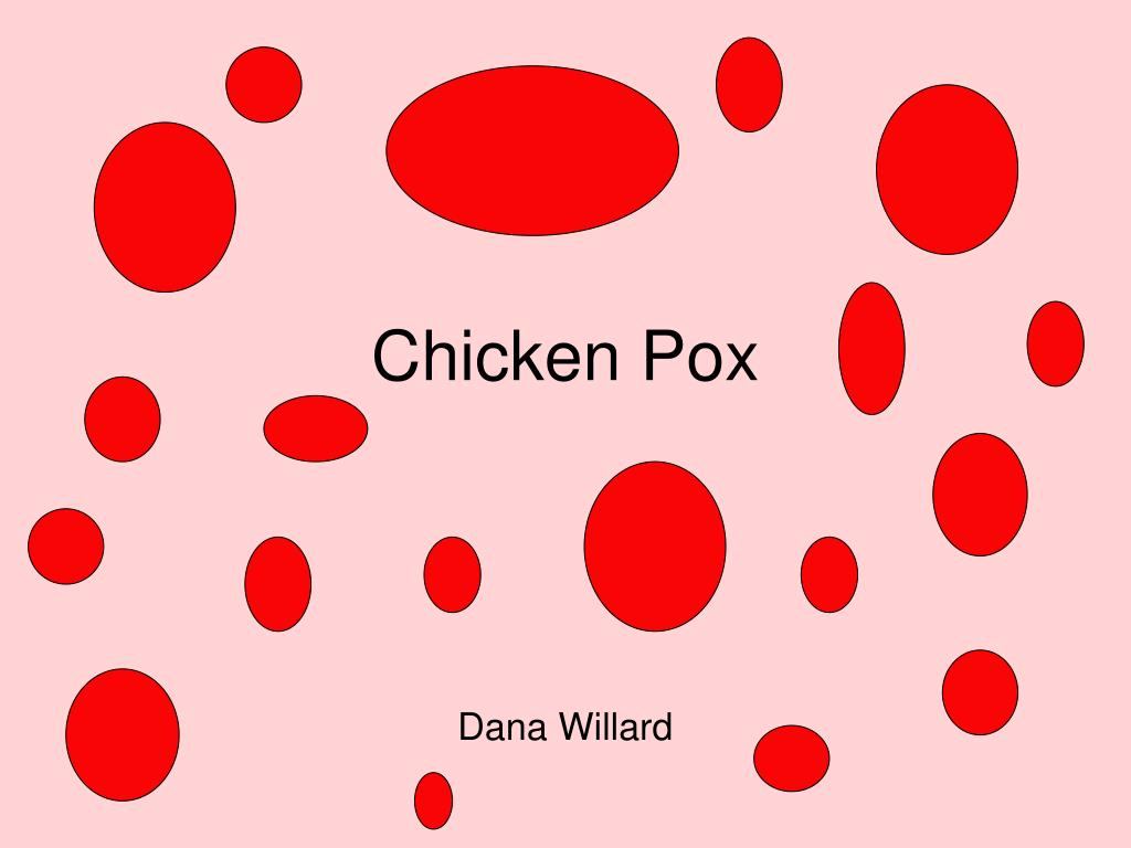 PPT - Chicken Pox PowerPoint Presentation, free download - ID:689720