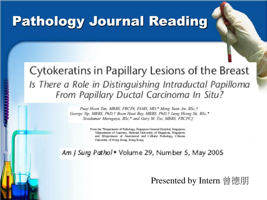 Duct papilloma ppt, Intraductal papilloma presentation
