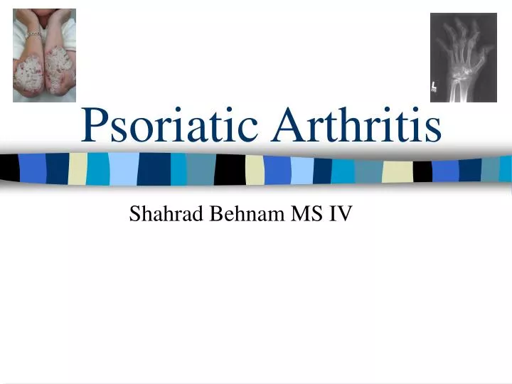 psoriatic arthritis n.