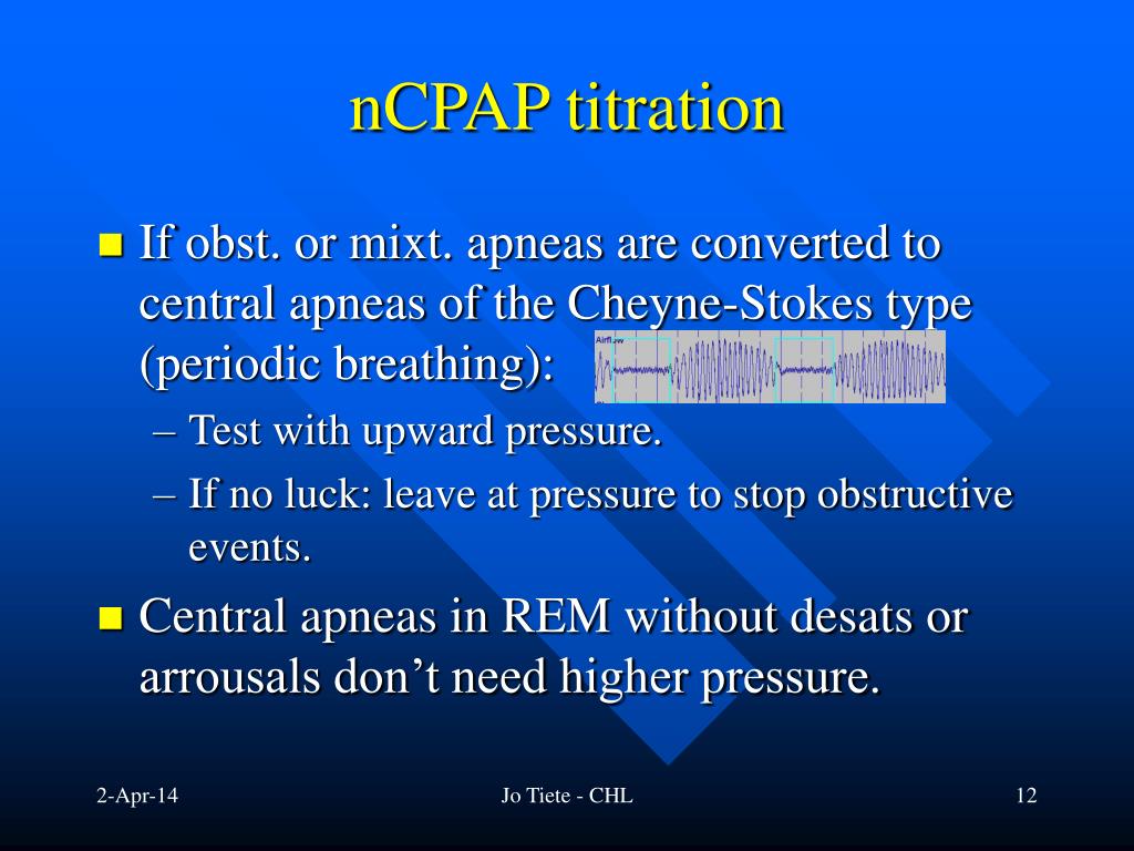 PPT Guidelines to CPAP & BiLevel device pressure titration in adults