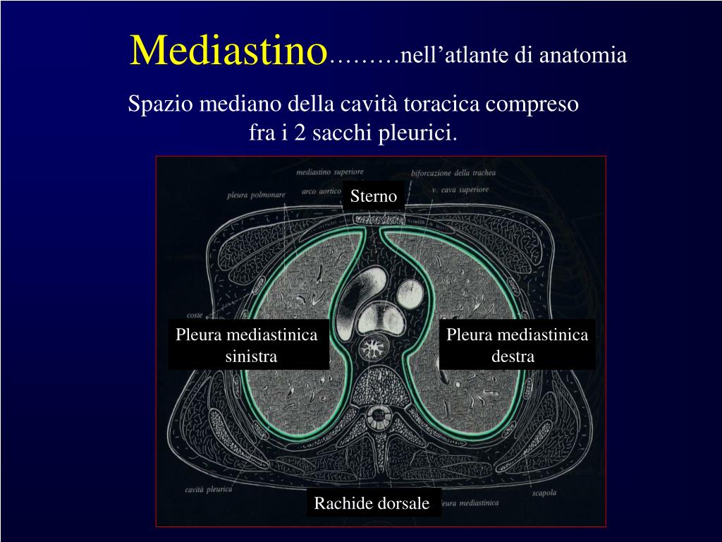 PPT - Masse mediastiniche PowerPoint Presentation, free download - ID:715433