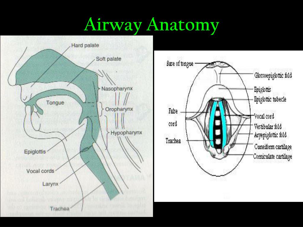 Upper Airway Anatomy Pic
