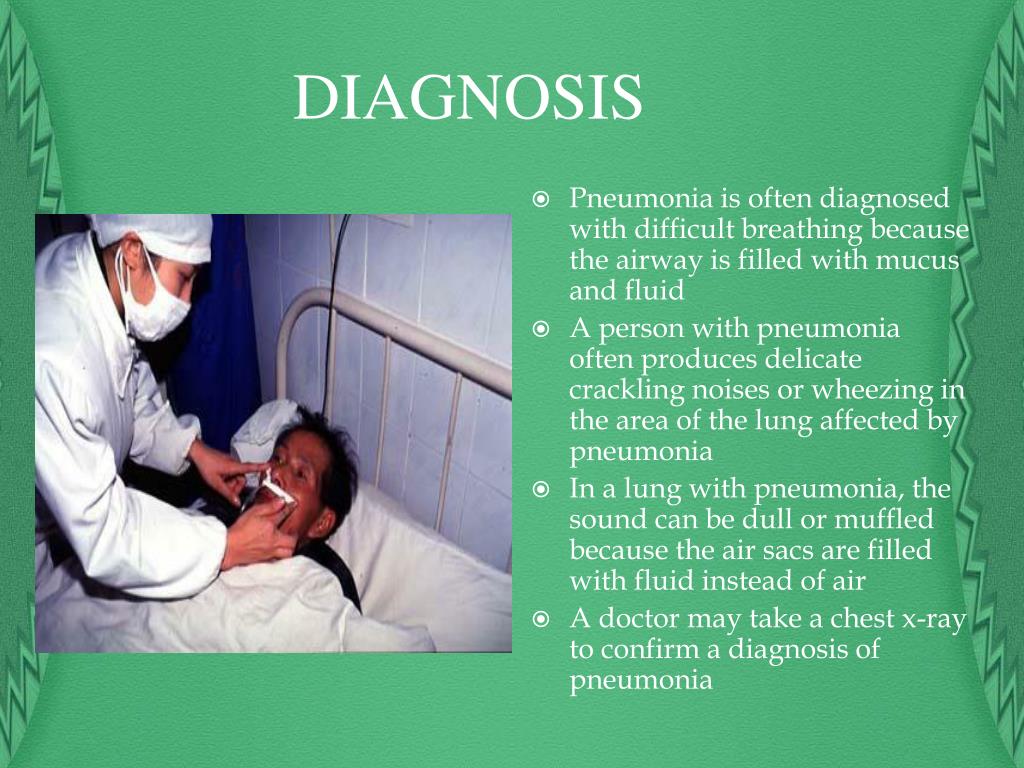 pneumonia case presentation slideshare