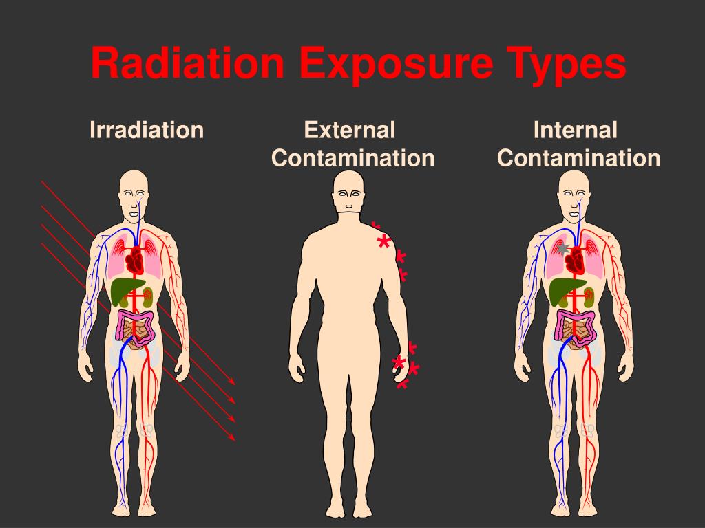 PPT Studies of impact of ionizing radiation on the human body