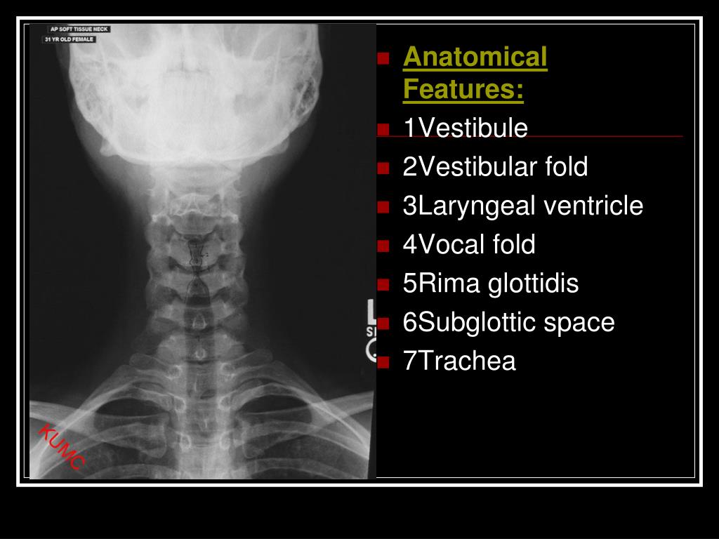 Ppt Soft Tissue Neck Powerpoint Presentation Free Download Id720035