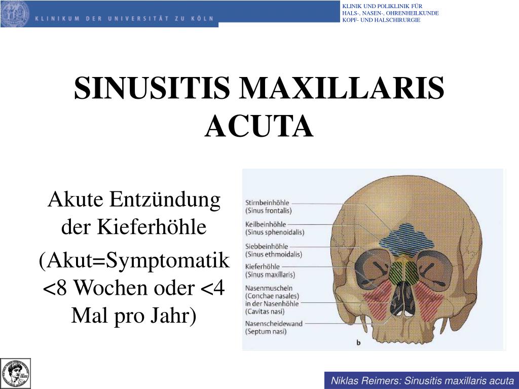 Acuta латынь. Hiatus maxillaris латынь. Sinus maxillaris статья.
